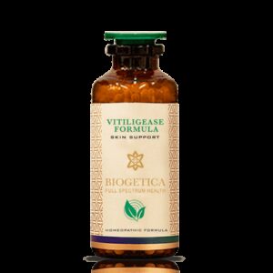 Vitiligease Formula