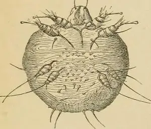Scabies Management in Homeopathy